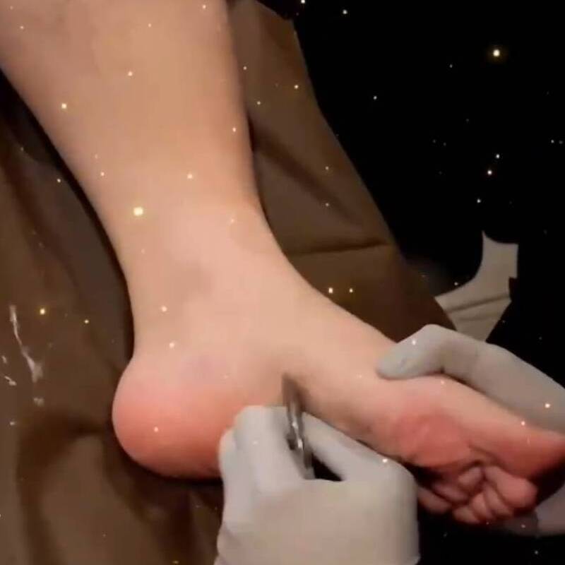 >運動筋膜刀腳底按摩｜Sports fascia Foot massage